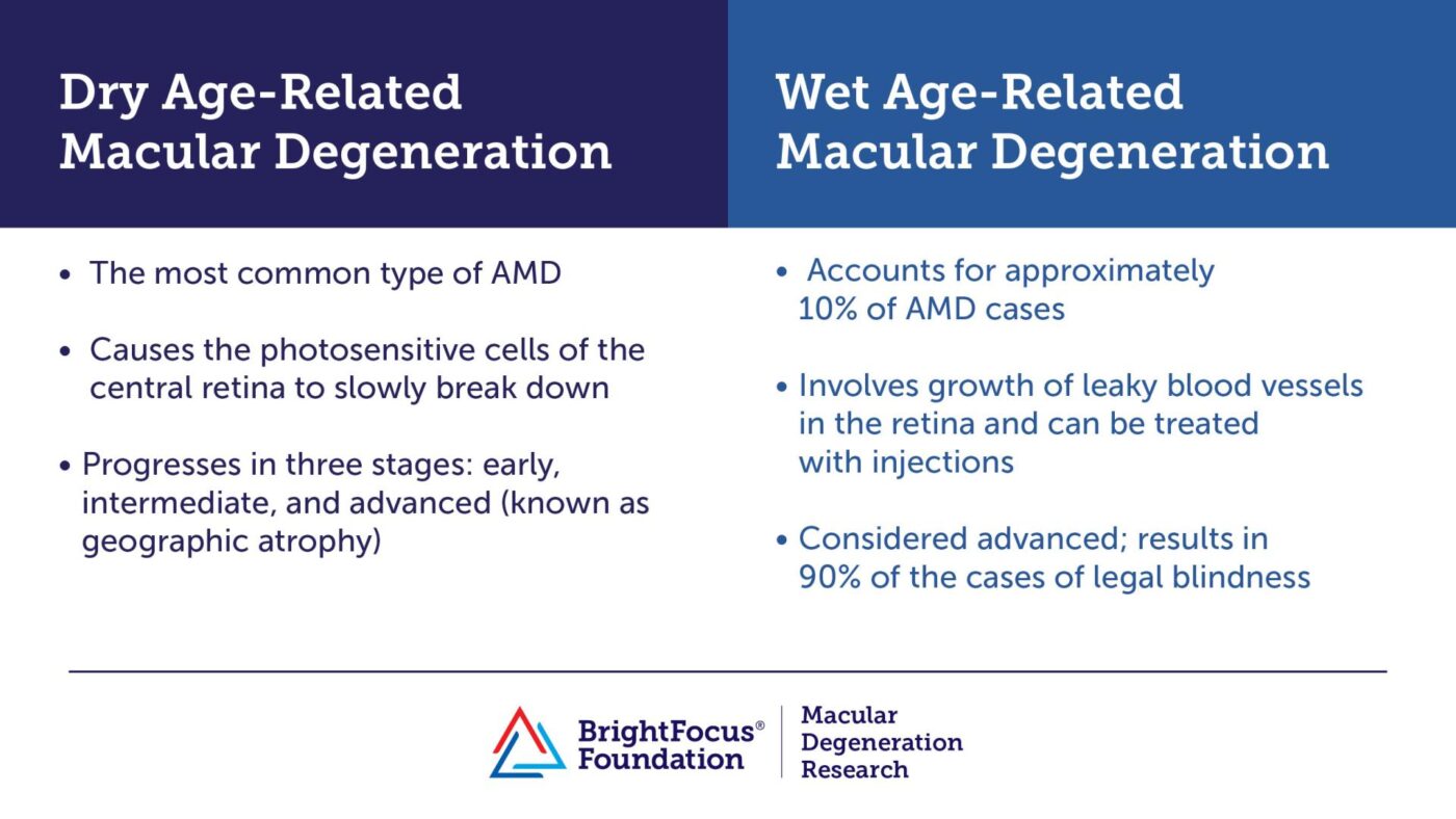 Dry vs. Wet Age-Related Macular Degeneration: What’s the Difference?