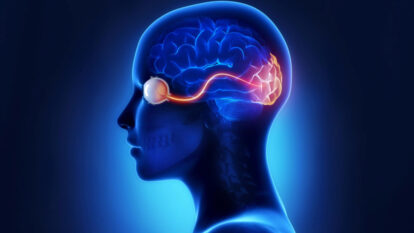 Spatial Vision Problems When Alzheimer’s Disease Begins with Vision Problems