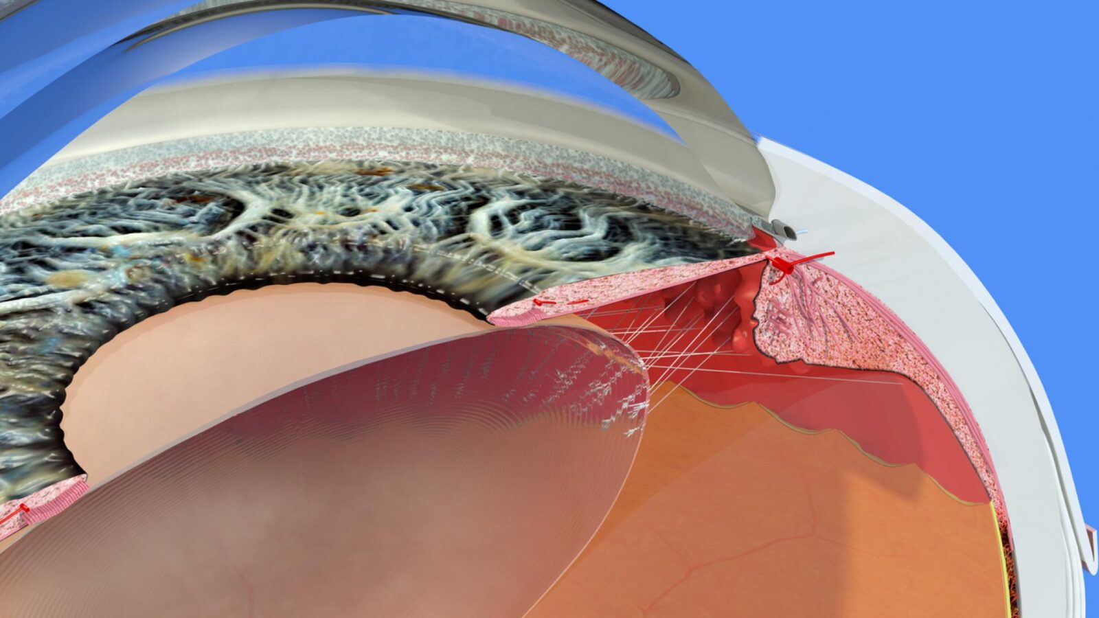 Trabevular Meshwork Scientists Discover Key Gene Associated with Glaucoma in Humans