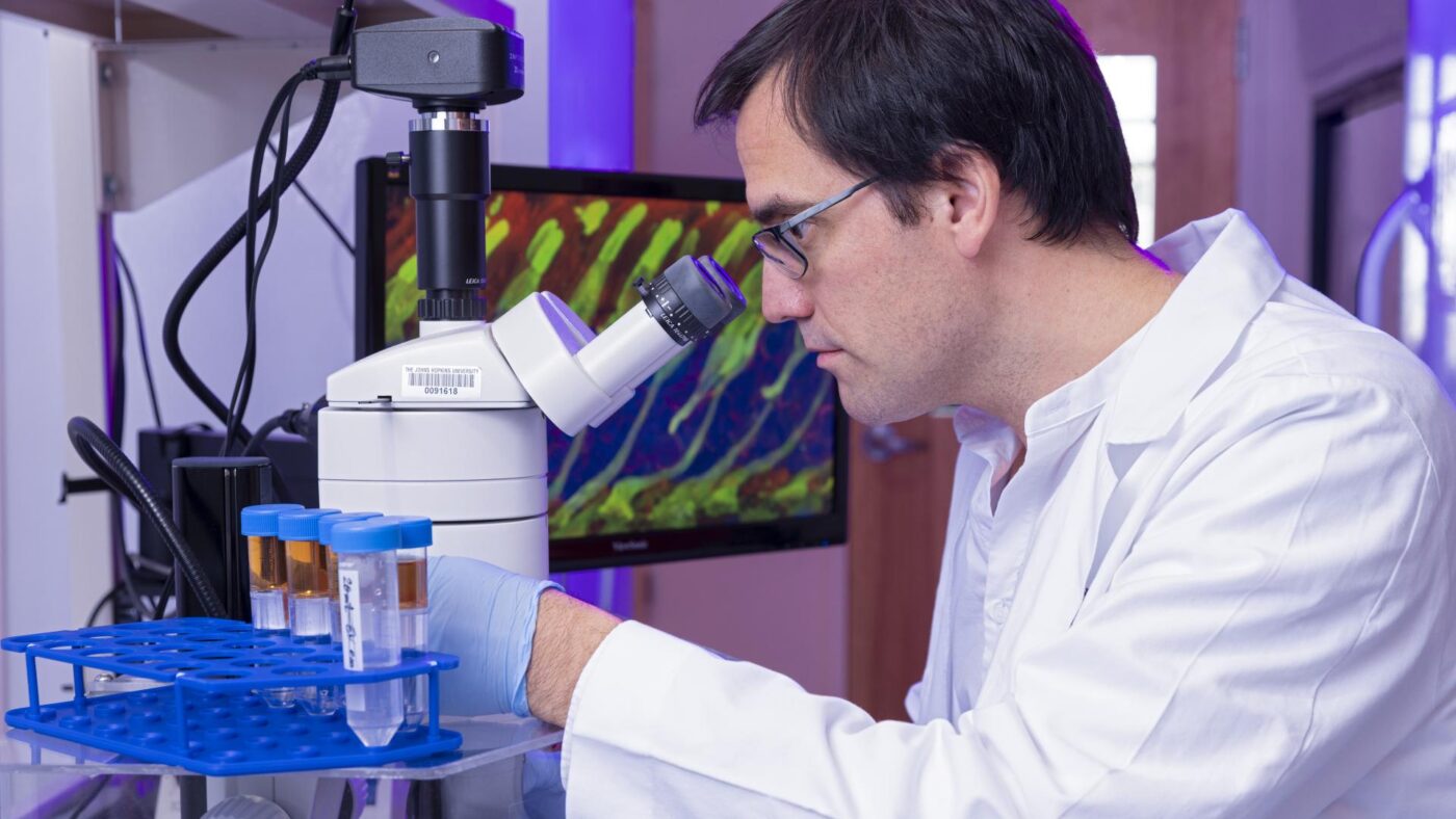 Macular Degeneration Research Program Overview BrightFocus Foundation Macular degeneration research program overview brightfocus foundation