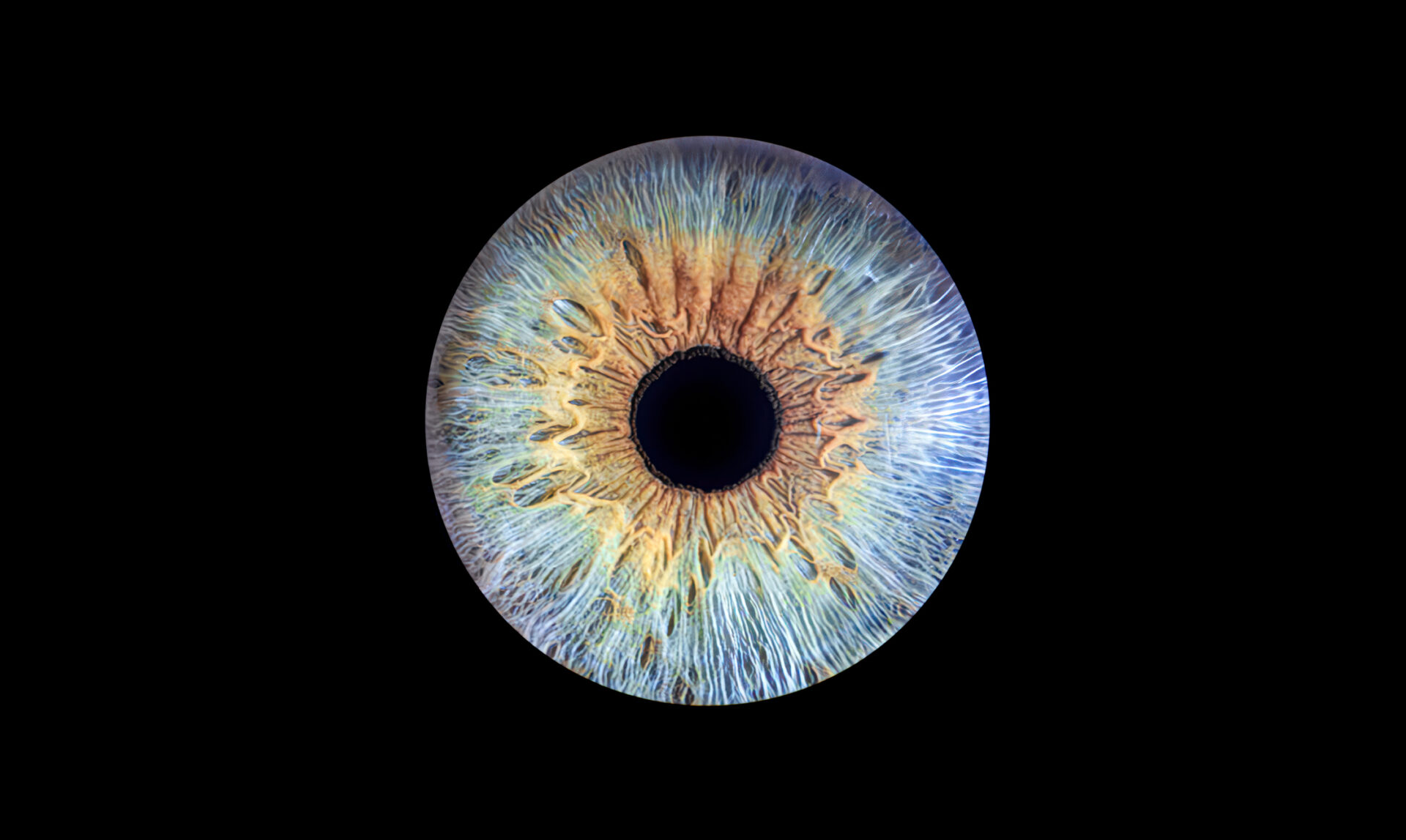 Macular Degeneration Research Program Overview BrightFocus Foundation Macular degeneration research program overview brightfocus foundation