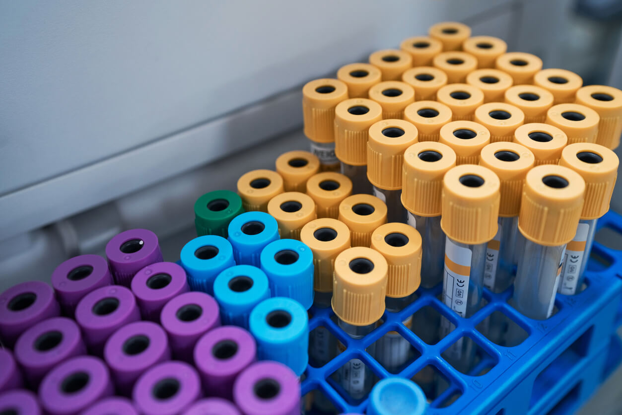 High angle view of samples in test tube rack at laboratory.