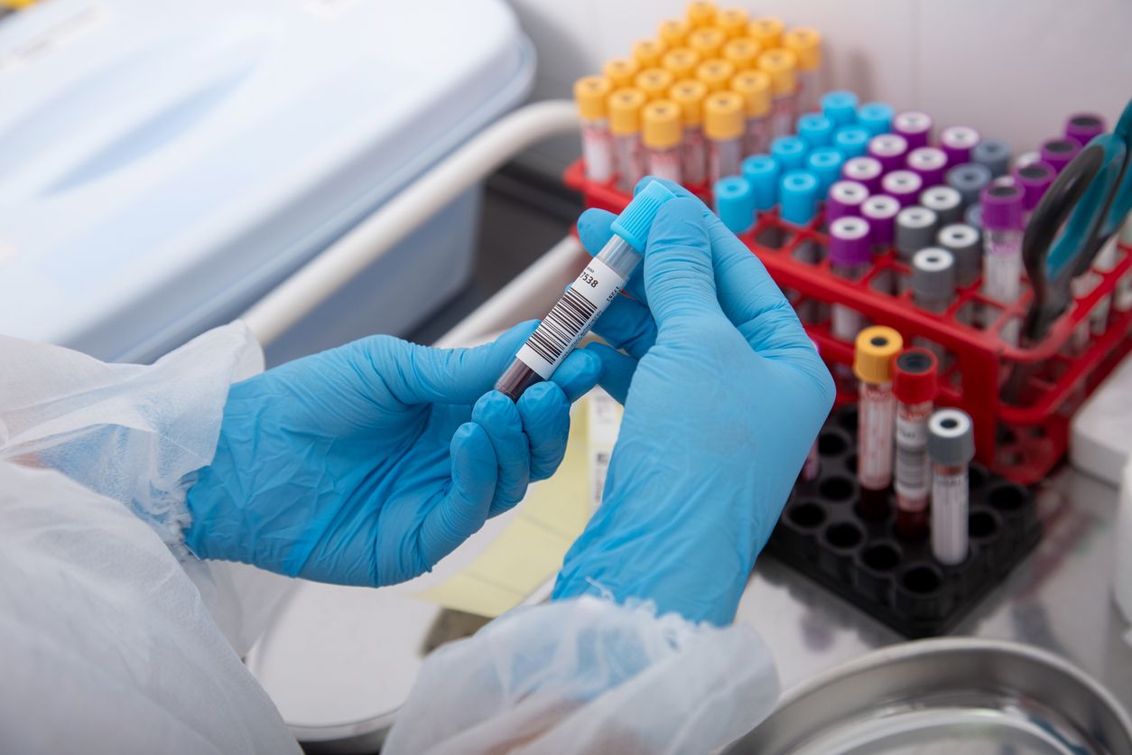 Laboratory assistant draws blood from a patient's vein with a disposable syringe.