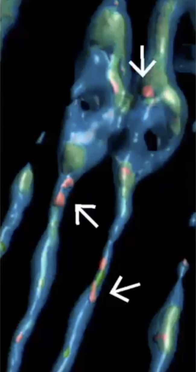 Visualization of mitochondria being digested in neurons.