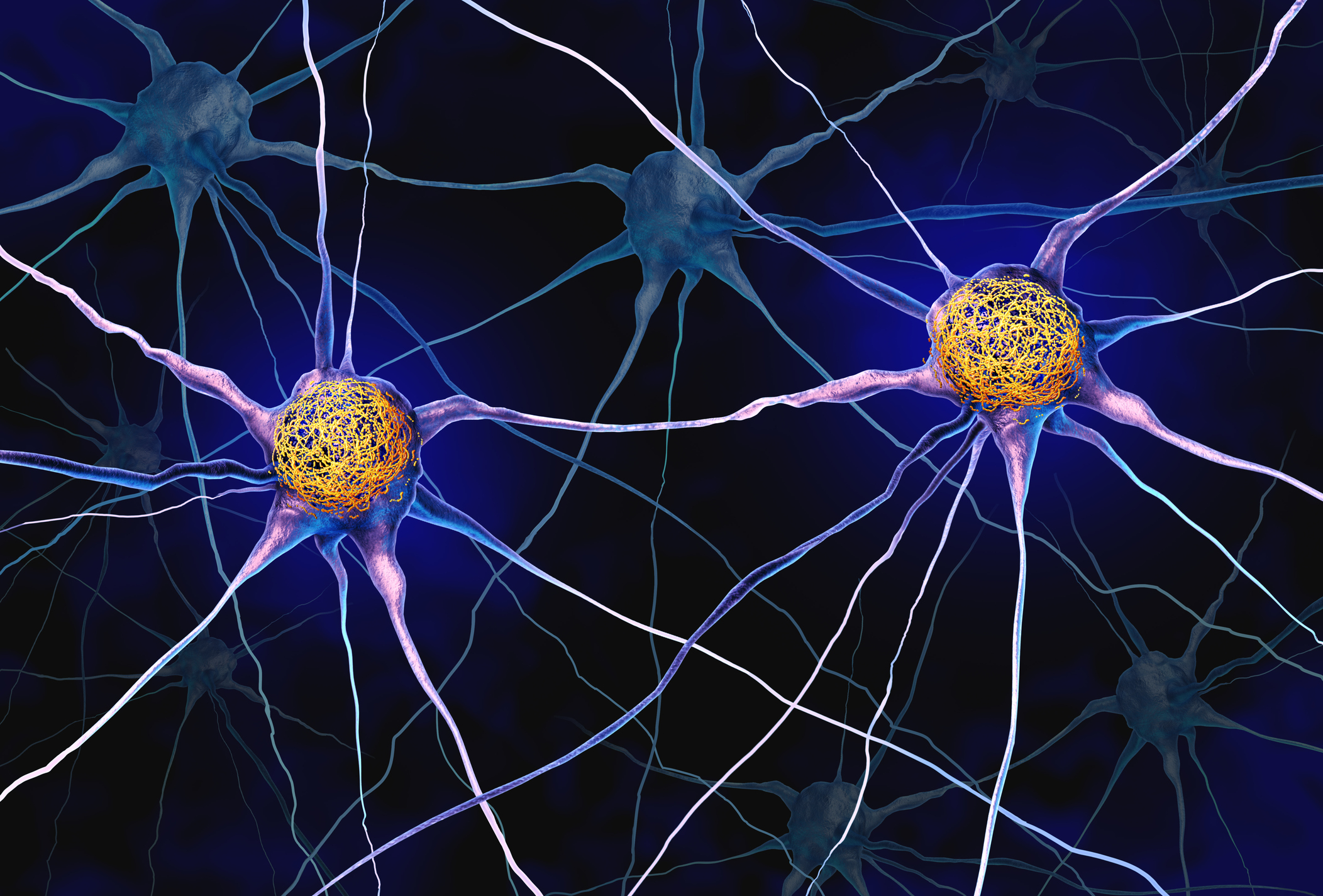 Tau Tangles inside the neuron cells resulting in memory loss and brain damage in Alzheimer’s disease as Misfolded proteins.